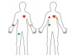 EKG monitoring srdeční frekvence, modul s AD8232